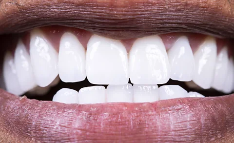 Getty Images A close up of a smiling mouth (Credit: Getty Images)