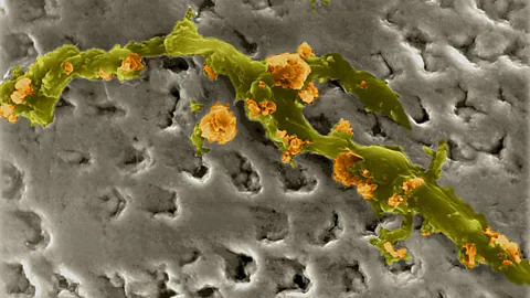 Alamy At a microscopic level, even the seemingly smooth surface of a tooth has plenty of crevices for microbes to live in (Credit: Alamy)